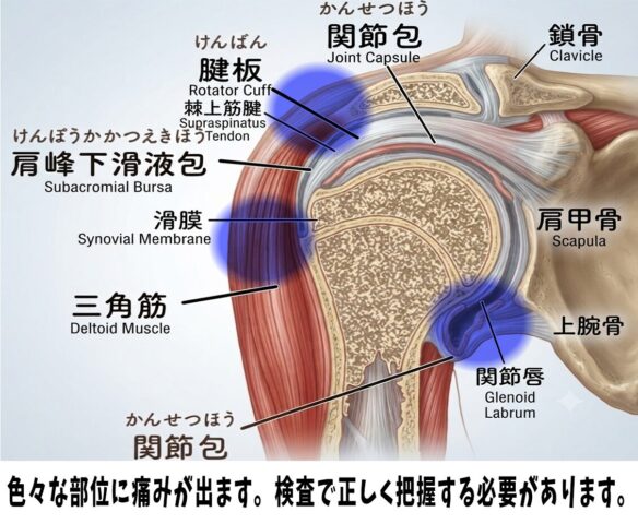 奈良市で五十肩にお悩みの方へ